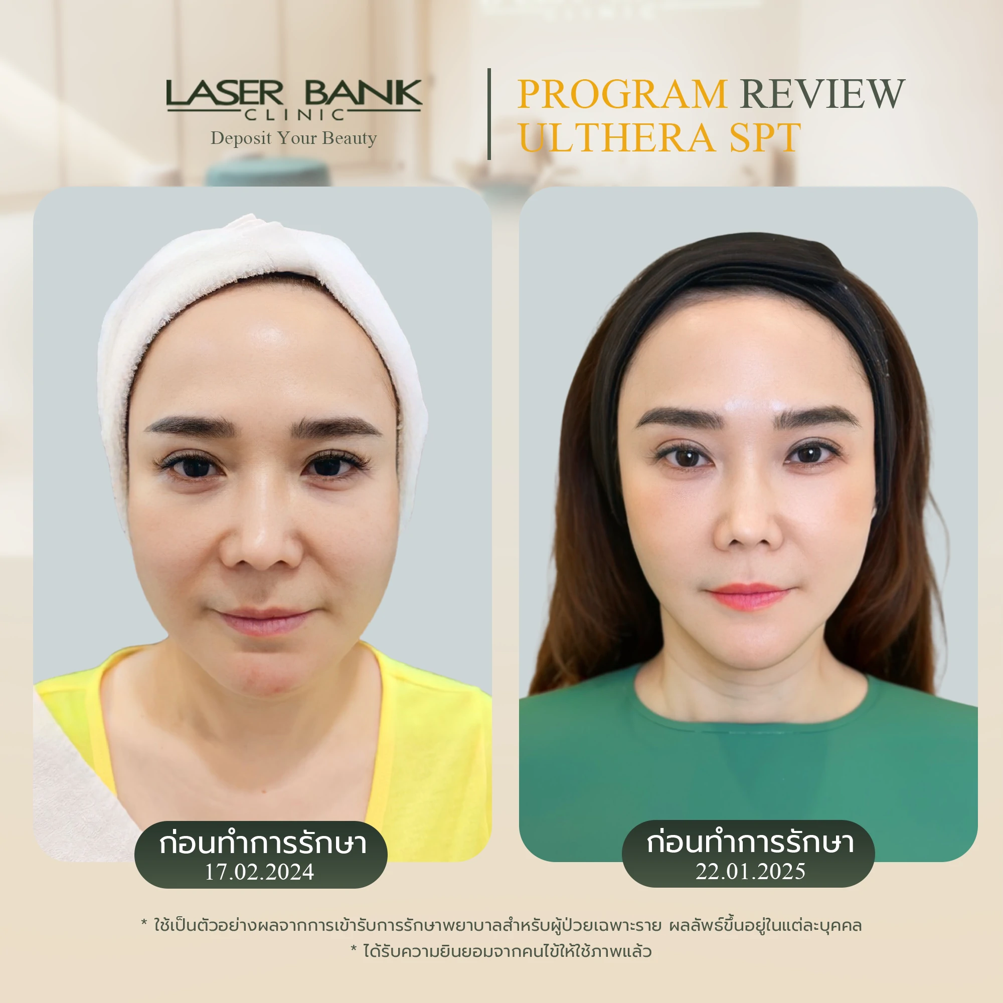 Before & After 1