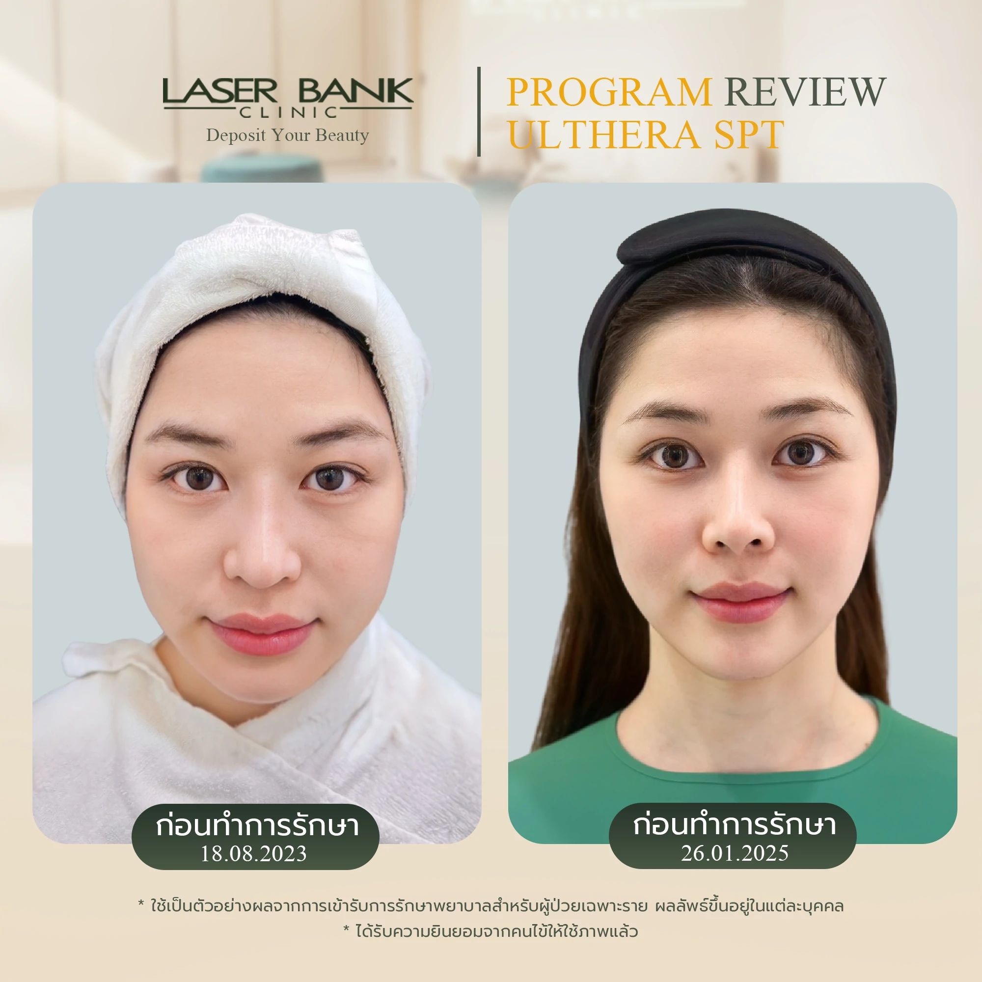 Before & After 2